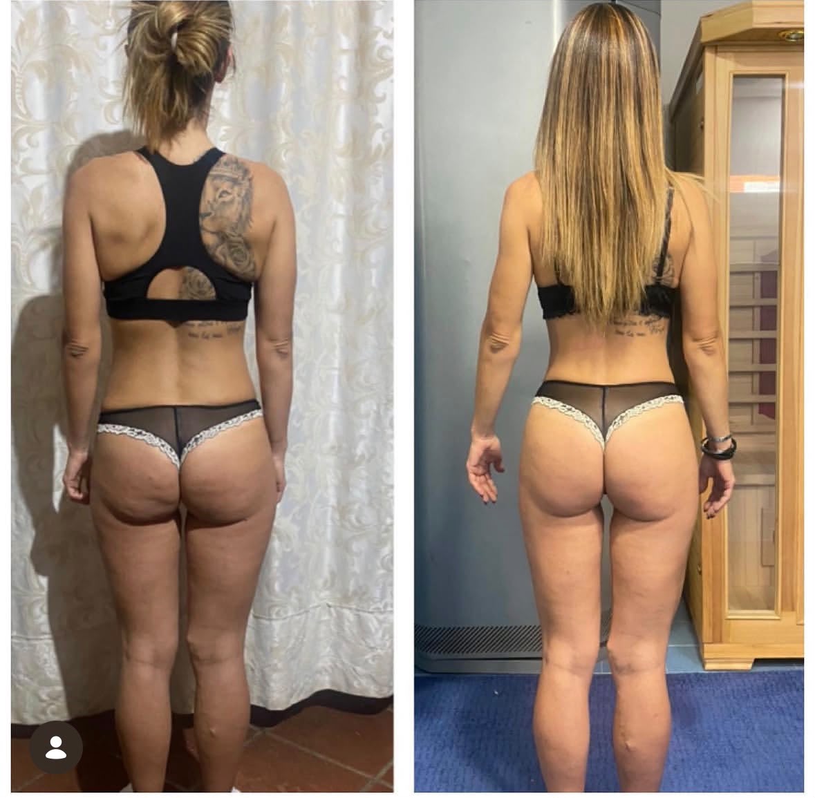 Trasformazione femminile vista posteriore: glutei e qualità cutanea