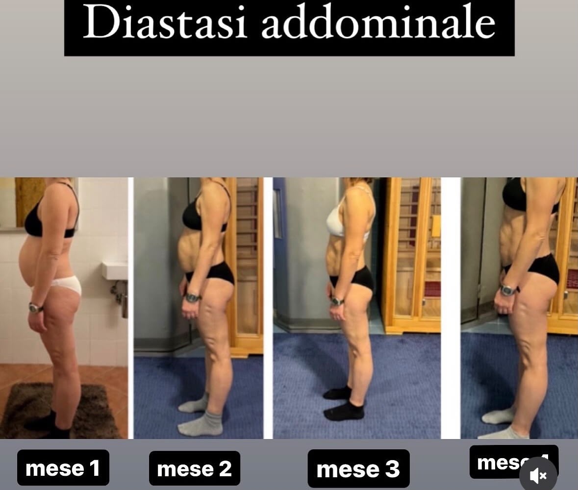 Percorso femminile su diastasi addominale, progressione mese per mese